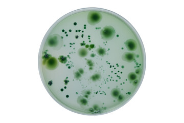 Colonies of different bacteria and mold fungi grown on Petri dish with nutrient agar, Test various...