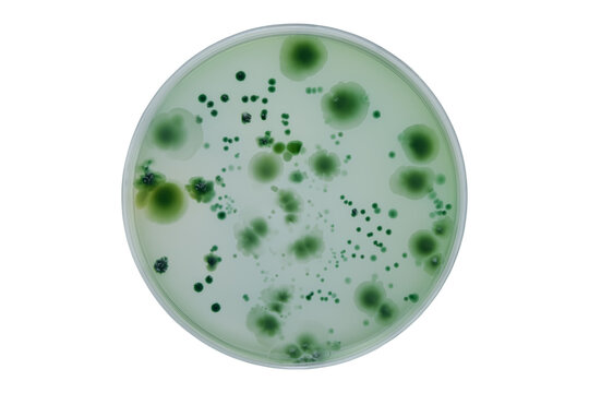 Colonies of different bacteria and mold fungi grown on Petri dish with nutrient agar, Test various germs, virus, Coronavirus, Corona, COVID-19, Microbial population count. Food science.