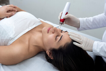 cosmetology treatment with dermapen technique for the care and beauty of the skin and health