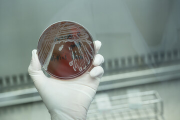 Scientist hand wearing white gloves hold agar plate for diagnosis bacterial or  microorganism at...
