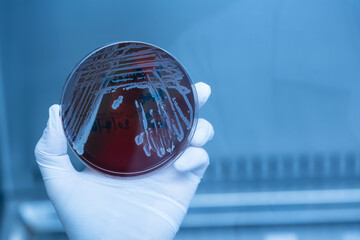 Scientist hand wearing white gloves hold agar plate for diagnosis bacterial or  microorganism at...