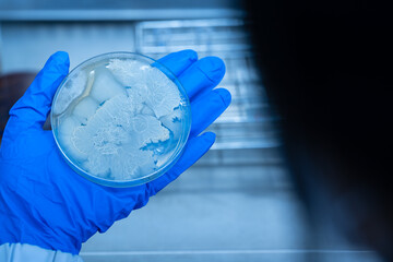 Scientist hand wearing blue gloves hold agar plate for diagnosis bacterial or microorganism in the...