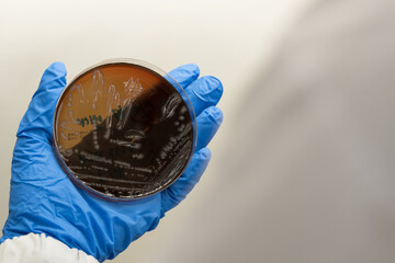 Scientist hand wearing blue gloves hold agar plate for diagnosis bacterial or microorganism in the...