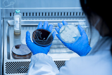 Scientist hand wearing blue gloves hold agar plate for diagnosis bacterial or microorganism in the...