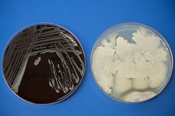 Top view two agar plate for diagnosis bacterial or  microorganism isolate on blue background at...