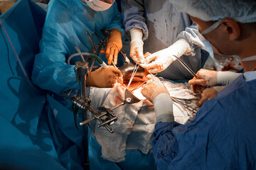 Close-up of the hands of surgeons performing a complex surgical operation in the open cavity of the...