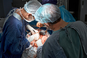 Top view of surgeons team during complex operation on open cavity of patient's body. Doctors leaned over patient using modern surgical instruments and clamps. Modern medicine, saving patient's life.