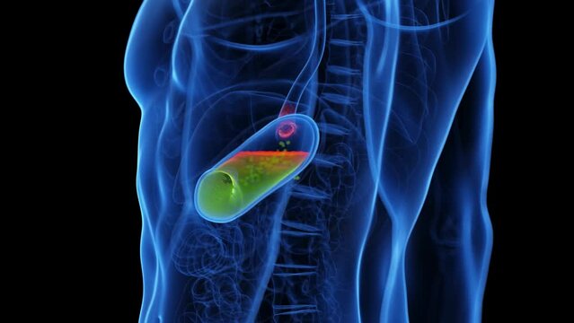 Animation of stomach acid reflux