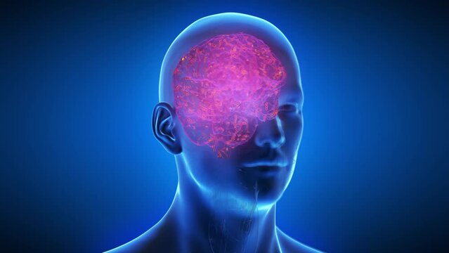 Animation of an inflamed human brain due to infection