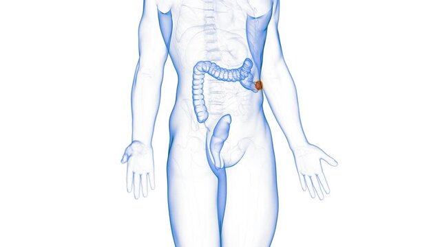 Animation of a large bowel undergoing colectomy procedure