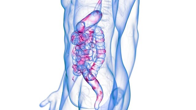 Animation of a colon affected by Crohn's Disease