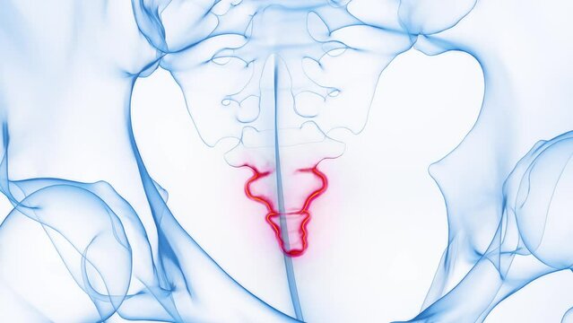 Animation of the inflamed tailbone