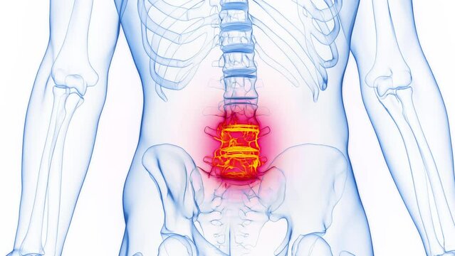 Animation of a man's inflamed lumbar vertebral bones