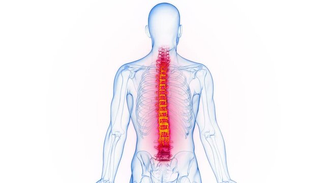 Animation of inflammation of the entire spine of a man