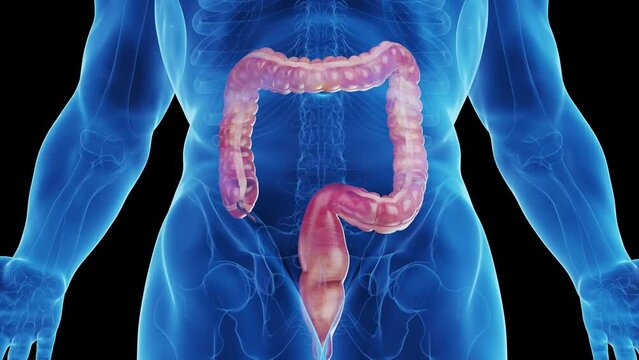 Animation of a man's large intestine