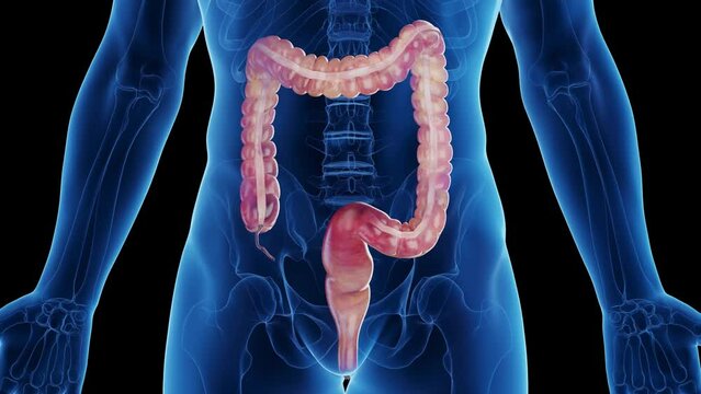 Animation of a man's large intestine