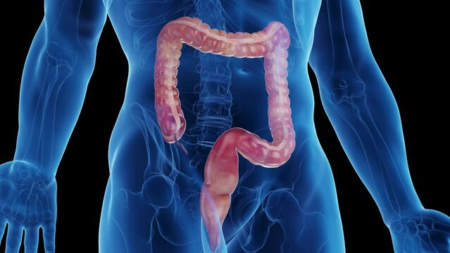 Animation of a man's large intestine