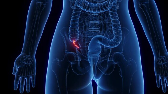 Animation of the appendix of a woman