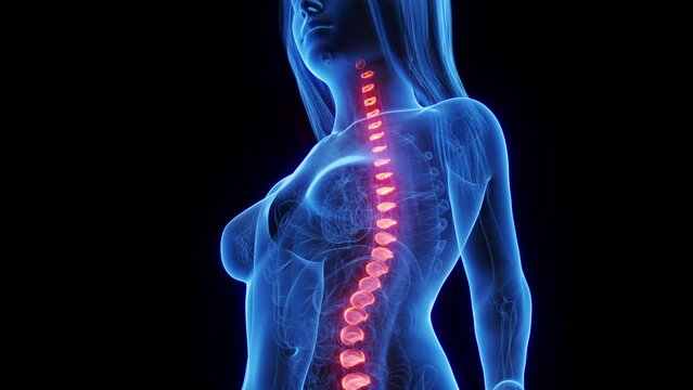 Animation of a woman's intervertebral discs