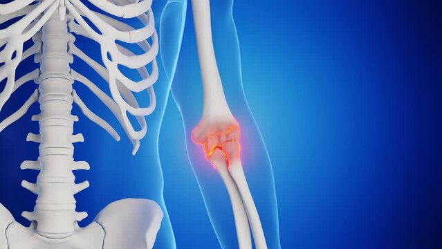 Animation of a man's left elbow