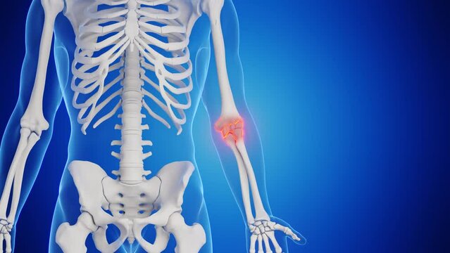 Animation of a man's left elbow