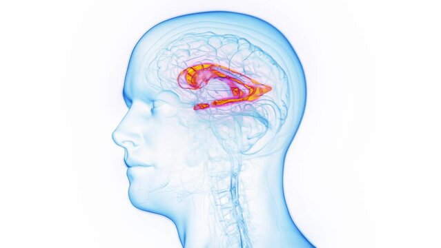 Animation of a man's lateral ventricle