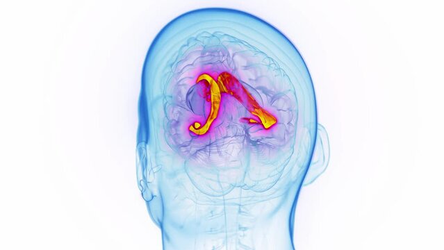Animation of a man's lateral ventricle