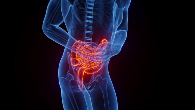 Animation of a man experiencing abdominal pain