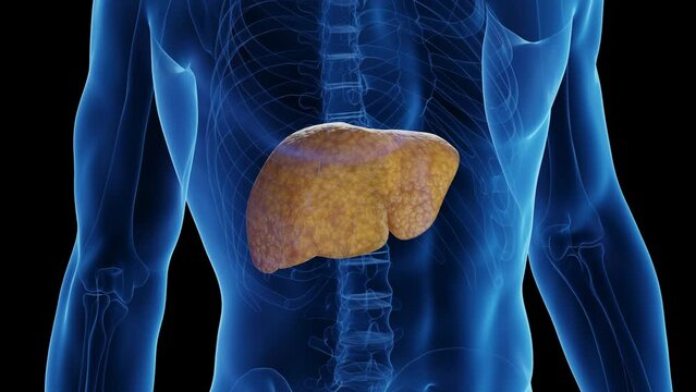 Animation of a man's fatty liver