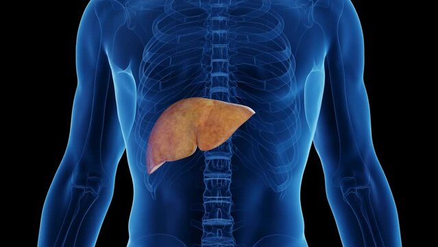 "Fatty Liver" Images – Browse 1,466 Stock Photos, Vectors, and Video ...