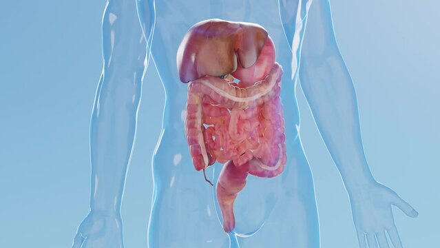 Animation of a man's inflamed digestive system