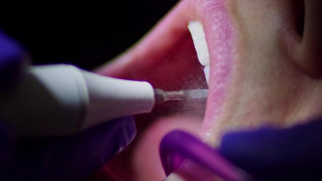 Real footage of a professional dentist cleaning the upper teeth of a woman patient from plaque and calculus with an electric tool using a strong jet of water close-up. Dental care