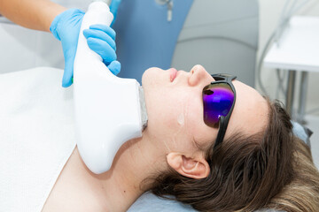 Laser hair removal on the face. A girl has her hair removed