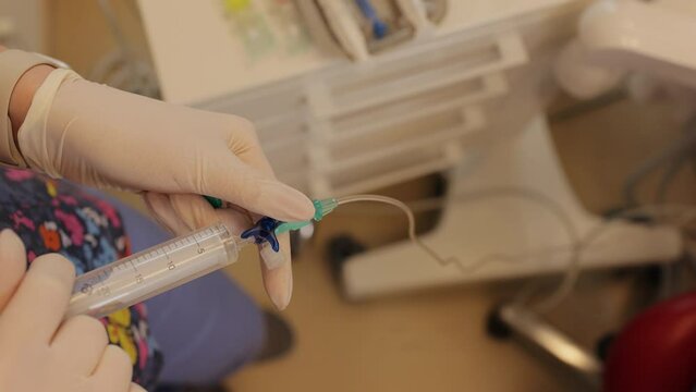 Injection of a catheter of a patient. Anesthesiologist or doctor put medicine in catheter for test and relief the pain. Epidural analgesia. Epidural nerve block