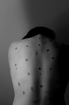 Grayscale photo of woman's back with dots all over