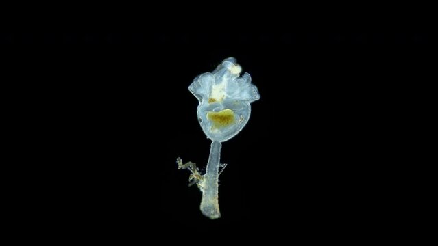 Entoprocta (Kamptozoa) family Pedicellinidae under a microscope, living in sea either singly or in colonies, were formerly considered a subclass of bryozoans. White Sea