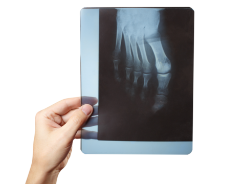Hand holding x-ray of foot, cut out