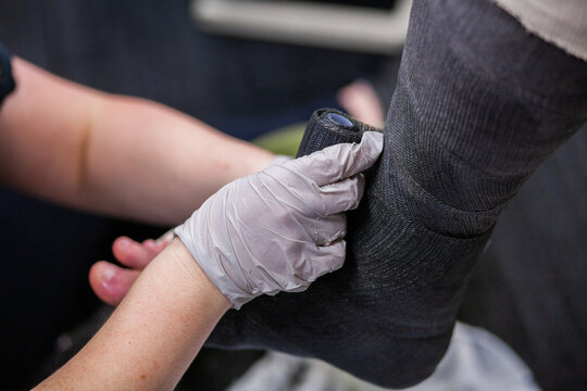 Medical cast being wrapped around leg