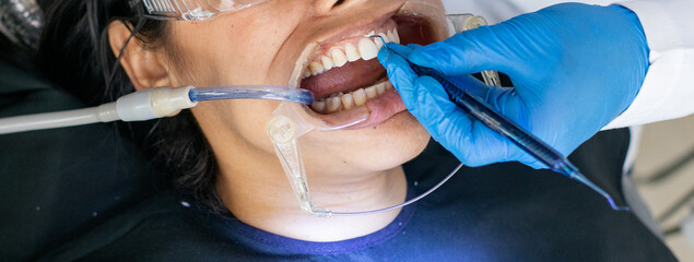 woman checking teeth in a dental office with a dentist