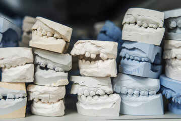 Warehouse of plaster models of human jaws in an orthodontic clinic. Control and diagnostic dental casts for aligners. - obrazy, fototapety, plakaty