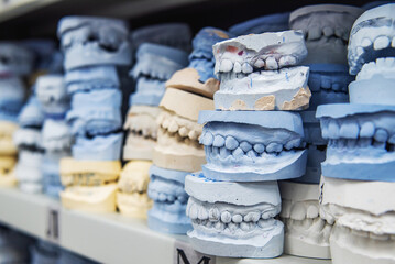 Warehouse of plaster models of human jaws in an orthodontic clinic. Control and diagnostic dental...