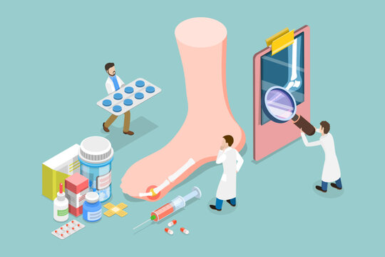 3D Isometric Flat Vector Conceptual Illustration of Gout Treatment, Medical Appointment and Exam