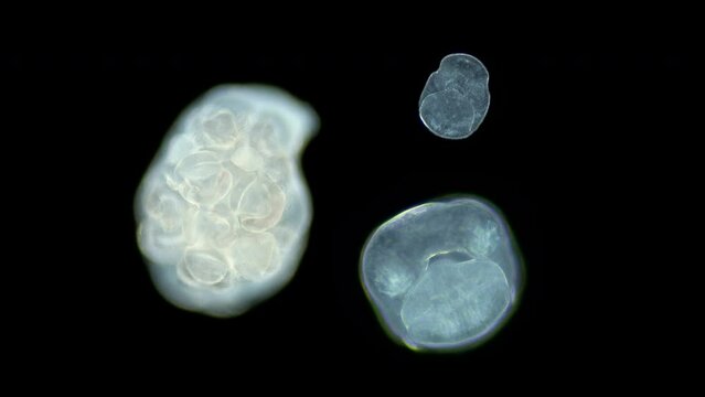 Sporocyst and young circaria of parasitic worm Microphallus sp. under a microscope, class Trematoda. Order Plagiorchiida . White Sea