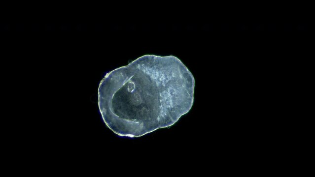 Young circaria of parasitic worm Microphallus sp. under a microscope, class Trematoda. Order Plagiorchiida . White Sea