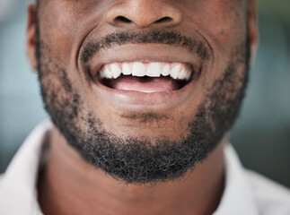 Dental, smile and mouth of man closeup for cosmetic, care and oral hygiene treatment results....