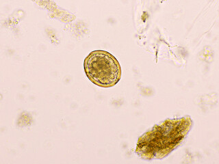 Egg of Ascaris lumbricoides (roundworm) in human stool, analyze by microscope, 400x