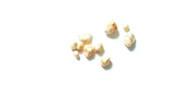 Gallstones removed from a persons gall bladder by surgery