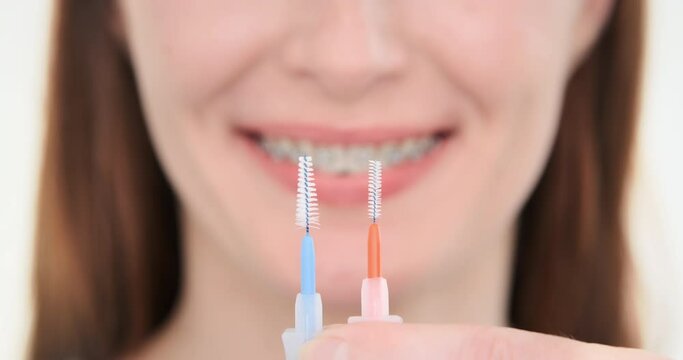 Interdental brushes for cleaning teeth, close up. Smiling woman holding different interdental brushes for brushing teeth in dental braces. Orthodontic toothbrush. Dental hygiene. Dentistry mouth care