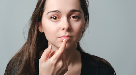 Fototapeta premium Virus herpes on lips close-up. Beautiful woman holds on finger a cream drop in front of painful lips. Portrait of young beautiful girl European appearance with infection injury. Dermatology sickness
