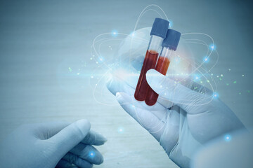Hand of a doctor holding a bottle of blood sample.